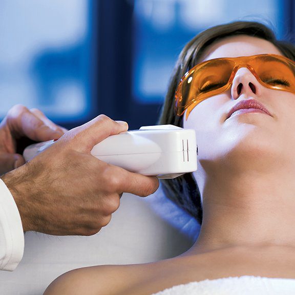 laser-removal